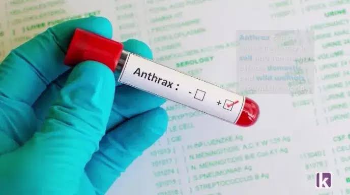 FG alerts public on Anthrax outbreak