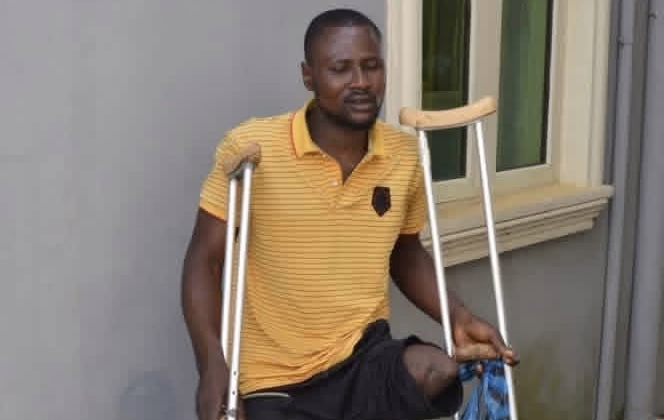Tragic Loss: Oluwasegun Olayinka, Amputee Shot by Ondo Amotekun, Passes Away