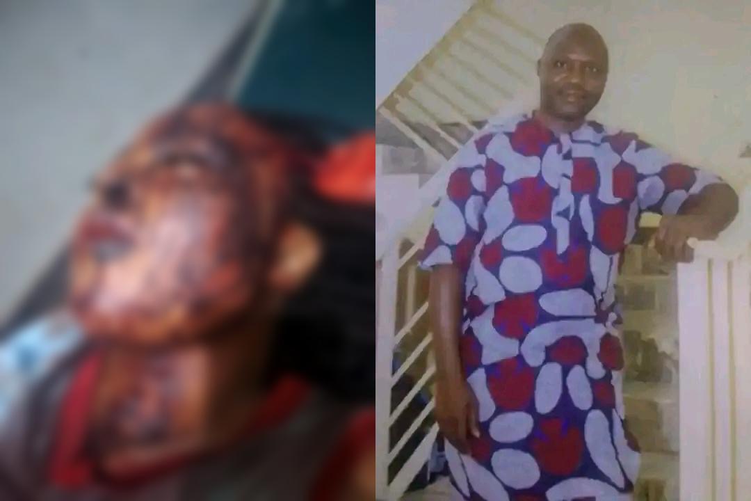 Woman Battles for Life After Alleged Near-Fatal Stabbing by Ex-Husband in Taraba